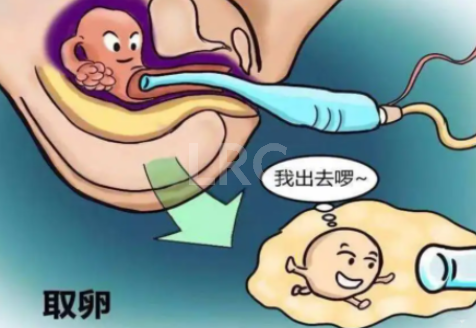 2026年泰国LRC对“畸形精子率高”有哪些提升精子质量的建议？