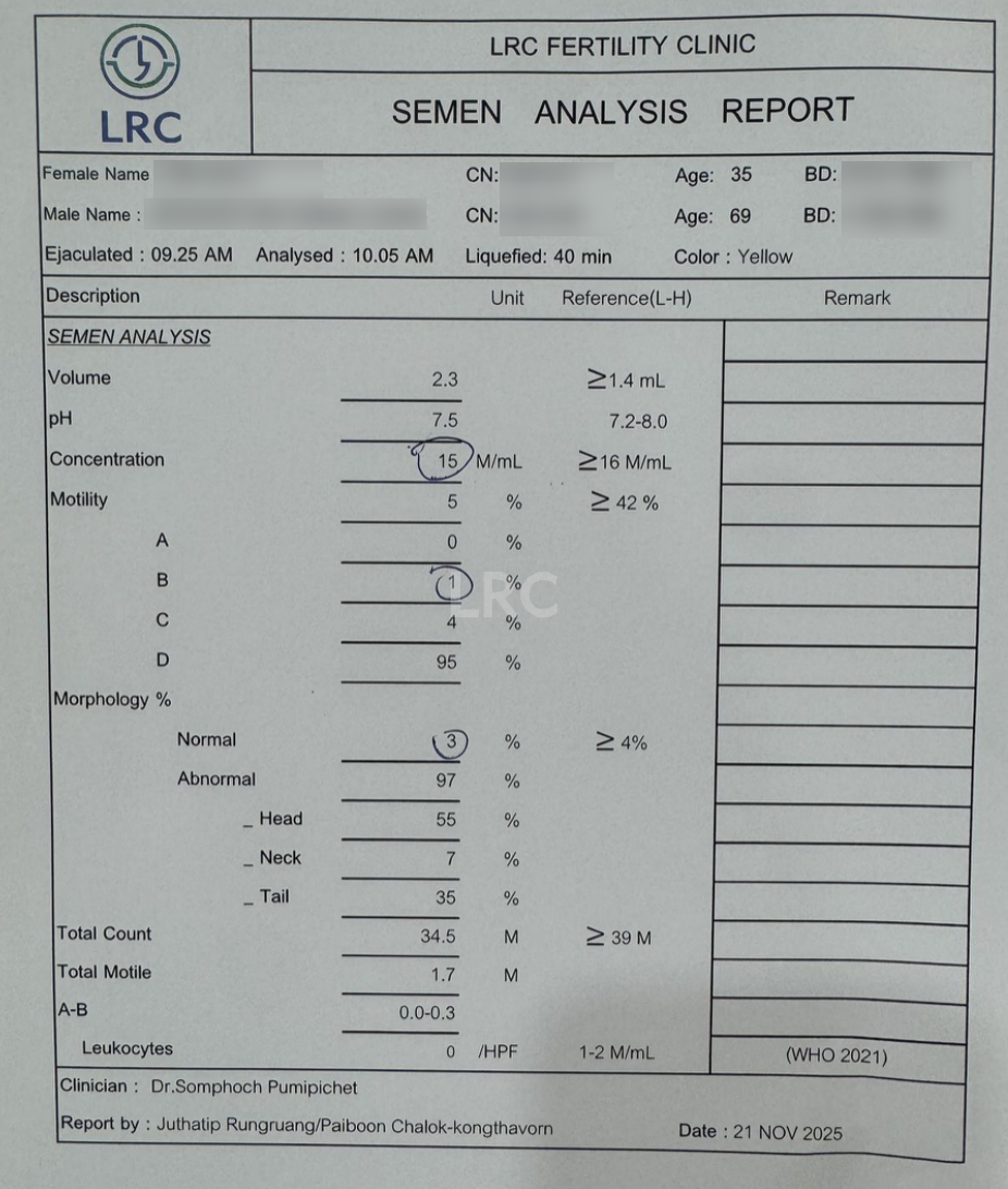 男方69岁重度弱精翻盘！LRC DGC高密梯度离心法+个性化促排方案，6周见胎心