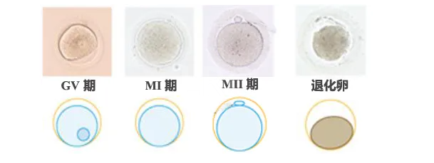LRC实验室卵子二次孵化技术 | MII成熟率80%-85% · 让每一枚卵子都不被浪费