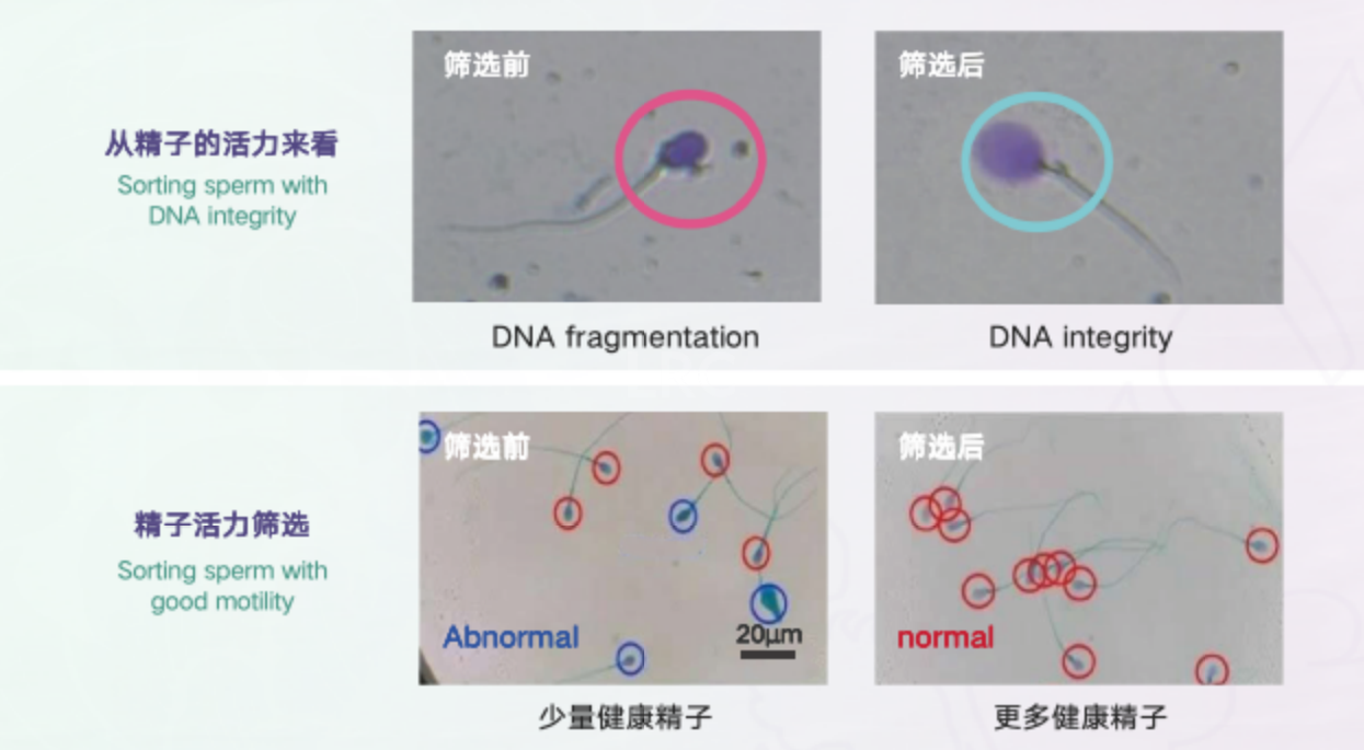 LRC好孕快筛晶片升级版 | 微流体技术精选高DNA完整性精子 · 从源头提升受精质量