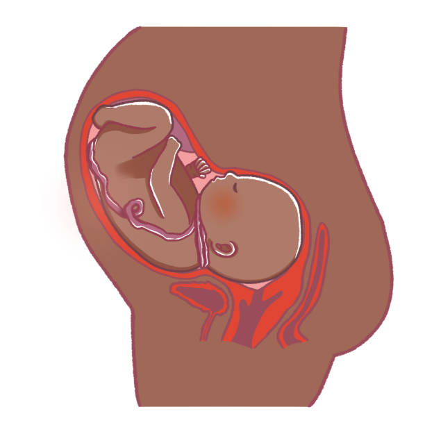 子宫腺肌症做泰国试管婴儿流程是什么样的？