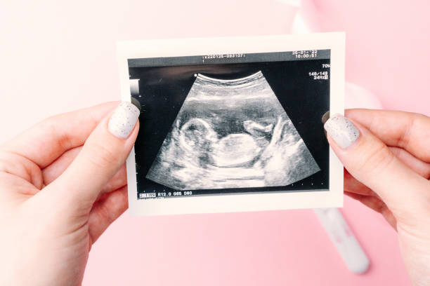 子宫内膜异位症能做试管婴儿吗？